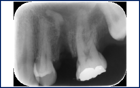 Other Surgery Examples